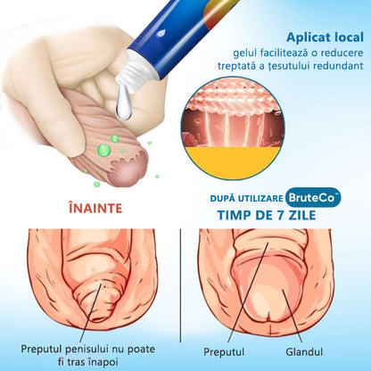 BruteCo™ gel pentru corectarea pielii nedorite (🔥 Ultima zi a promoției, 80% reducere🔥)