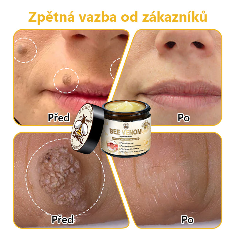 Poslední den 80% sleva👑BSWELL™ Bee Venom Skin Treatment Cream (doporučeno AAD) 🎉🎉