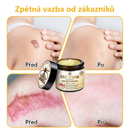 Poslední den 80% sleva👑BSWELL™ Bee Venom Skin Treatment Cream (doporučeno AAD) 🎉🎉