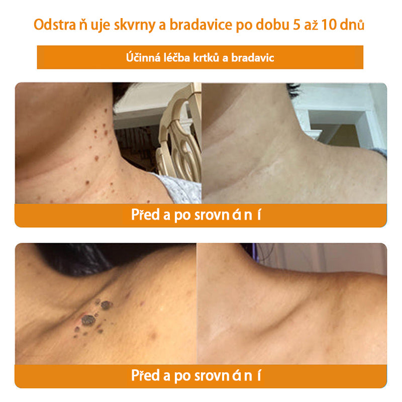 Poslední den 80% sleva👑BSWELL™ Bee Venom Skin Treatment Cream (doporučeno AAD) 🎉🎉